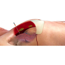 Load image into Gallery viewer, ARS® for Needle Decompression, 10 ga x 3.25 in